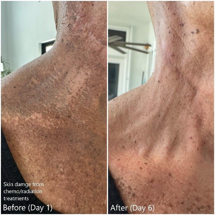 BFF Duo: Soothe & Renew - Golden 8 Skincare USA