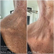 BFF Duo: Soothe & Renew - Golden 8 Skincare USA