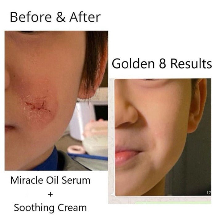 BFF Duo: Soothe & Renew - Golden 8 Skincare USA