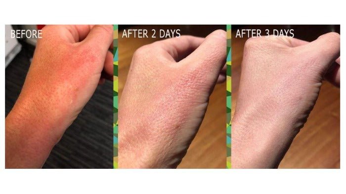 Miracle Oil Face Serum - Golden 8 Skincare USA